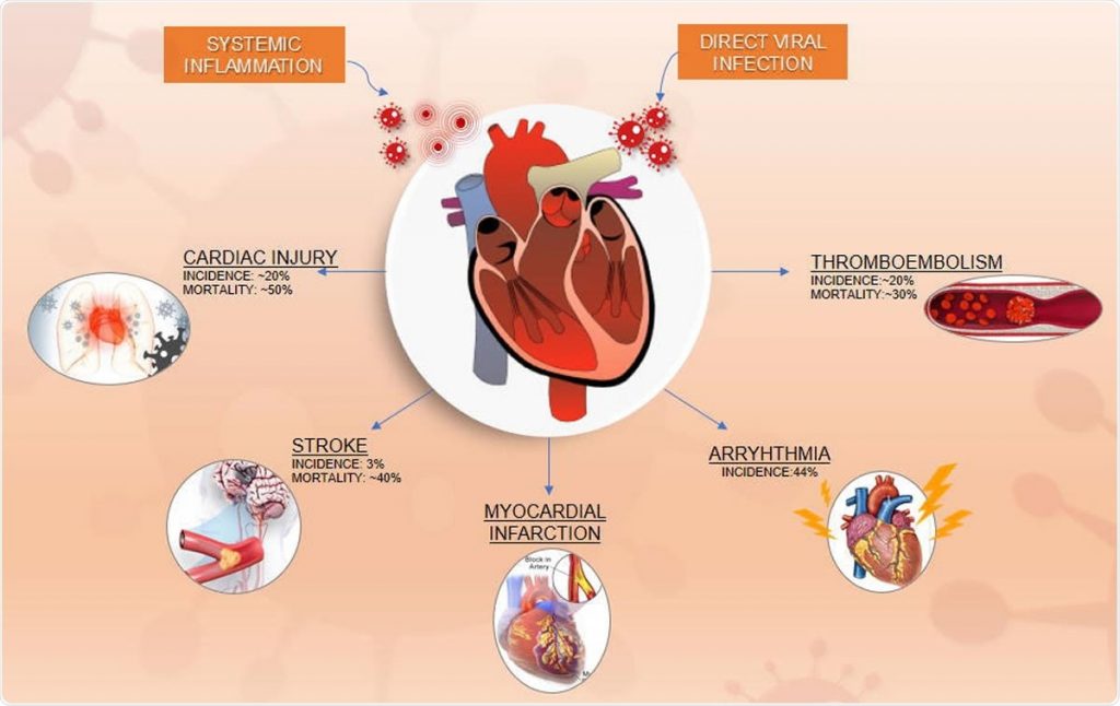  CBD Effects Heart Arrhythmia And Cardiovascular Heart Disease